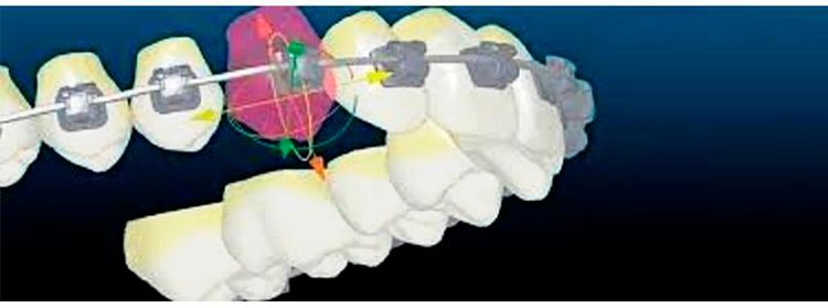 Clínica Ortego Odontología tratamientos 4