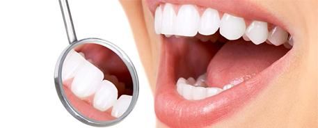 Clínica Ortego Odontología dientes blancos